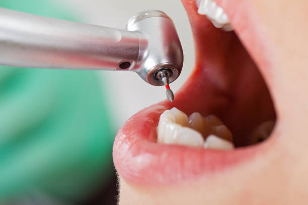 Best Emergency Treatment for Toothache in Adelino, NM